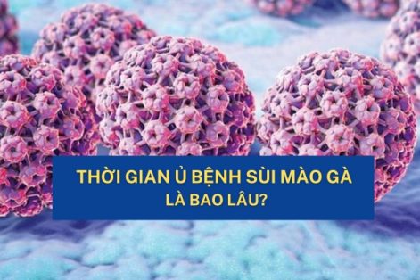 Thời gian ủ bệnh sùi mào gà là bao lâu?