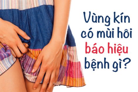 Âm đạo có mùi hôi là bệnh gì?