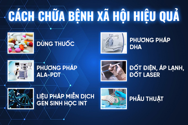 Cach-chua-benh-xa-hoi