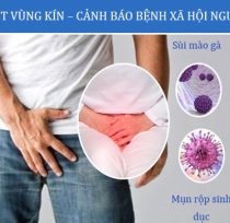 Lo-loet-vung-kin