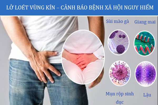 Lo-loet-vung-kin