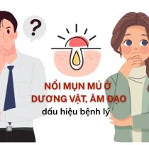 Mun-mu-o-duong-vat-am-dao