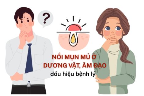 Nổi mụn mủ vùng kín nam và nữ cảnh báo các bệnh lý bạn không ngờ đến
