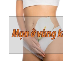 Mun-mu-vung-kin