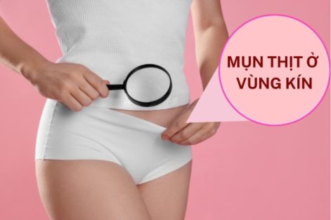 Nổi mụn thịt ở vùng kín là bị gì?