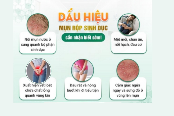Noi-mun-nuoc-o-vung-kin