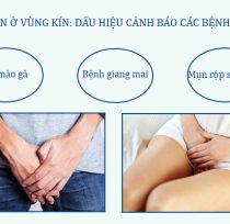Noi-mun-o-vung-kin