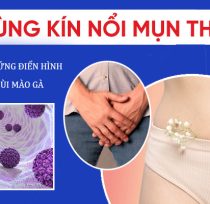 Noi-mun-thit-o-vung-kin