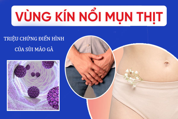 Noi-mun-thit-o-vung-kin