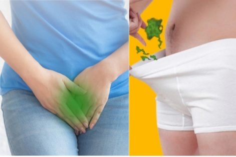 Vùng kín hôi có phải sùi mào gà?