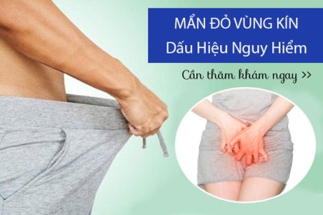 Cảnh báo vùng kín nổi mẩn đỏ có liên quan đến các căn bệnh nguy hiểm