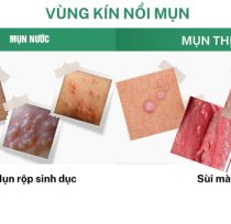 Vung-kin-noi-mun (1)