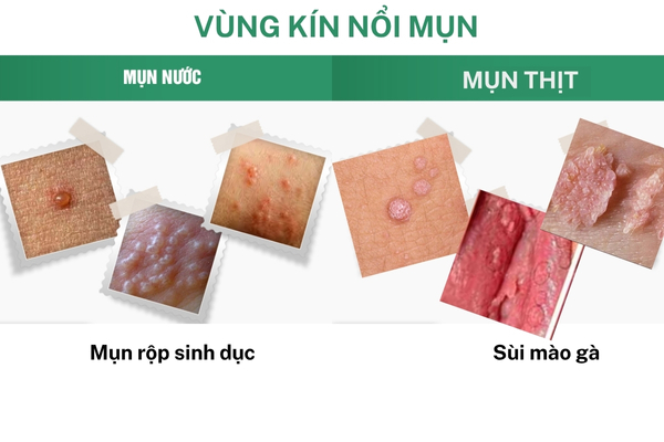 Vung-kin-noi-mun (1)
