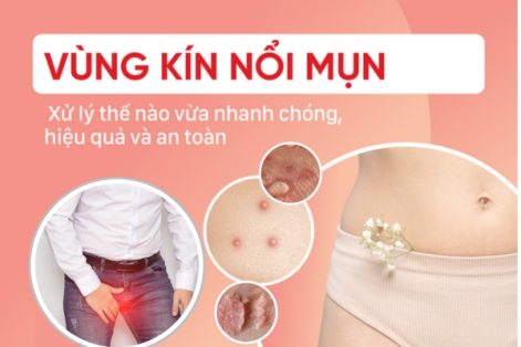 Mọc mụn vùng kín nam nữ cảnh báo bệnh xã hội nguy hiểm