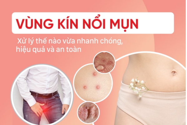 Vung-kin-noi-mun