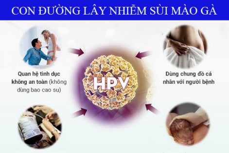 Tổng Quan Đầy Đủ Về Bệnh Sùi Mào Gà Ở Nam Và Nữ Giới