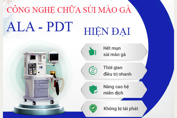 Cong-nghe-ala-pdt