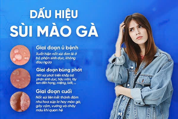 Dau-hieu-sui-mao-ga-nu