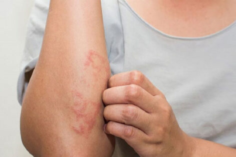 Tổng hợp các bệnh xã hội ở nam giới