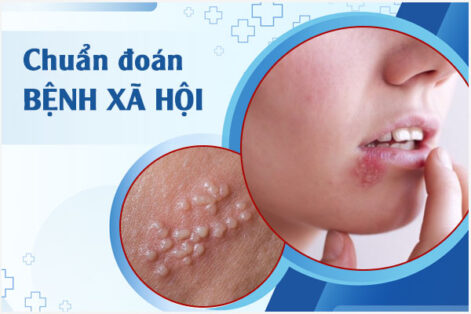 Tổng hợp các bệnh xã hội ở nữ giới
