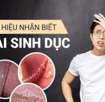 Gai-sinh-duc