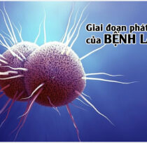 Giai-doan-cua-benh-lau