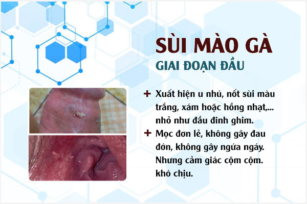 Giai-doan-sui-mao-ga-1