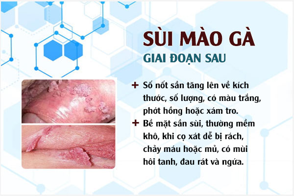 Giai-doan-sui-mao-ga-2