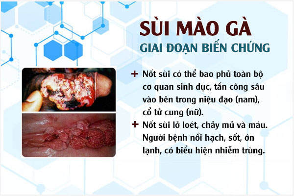 Giai-doan-sui-mao-ga-3