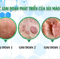 Giai-doan-sui-mao-ga-4