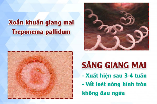 Giang-mai-gd1