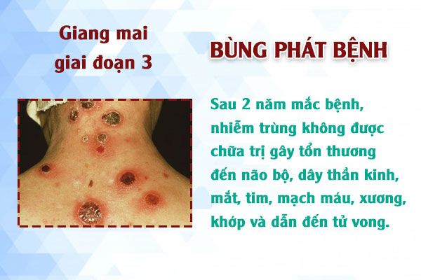 Giang-mai-gd3