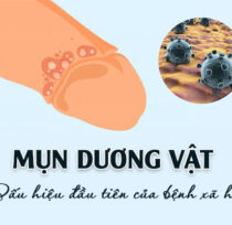 Mun-duong-vat