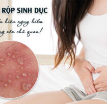 Mun-rop-sinh-duc