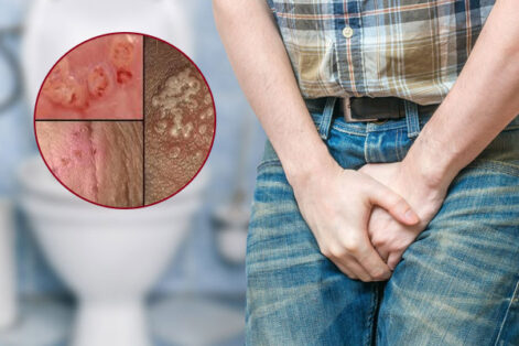 Bật mí cách điều trị bệnh lậu ở nam giới nhanh chóng và tiết kiệm chi phí