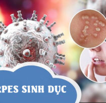 Herpes-sinh-duc