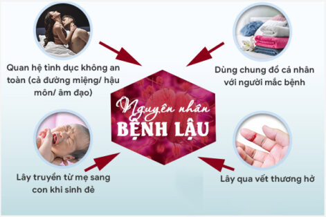 Nguyên nhân mắc bệnh lậu ở nam và nữ giới