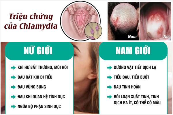 Trieu-chung-chlamydia